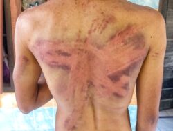 Diduga Curi 7 Janjang Sawit, Warga Silinda Babak Belur Dianiaya Oknum Keamanan PT Cinta Raja Silinda